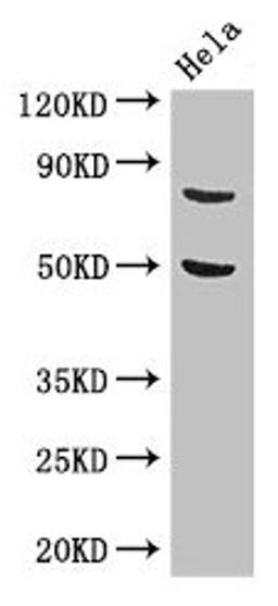Western Blot. Positive WB detected in: Hela whole cell lysate. All lanes: KBTBD6 antibody at 3.4µg/ml. Secondary. Goat polyclonal to rabbit IgG at 1/50000 dilution. Predicted band size: 77 kDa. Observed band size: 77 kDa
