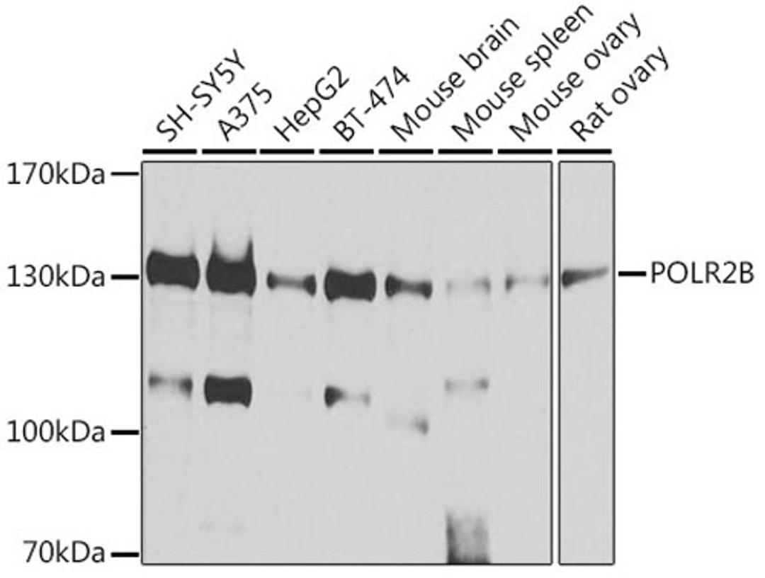 Western blot - POLR2B antibody (A5928)