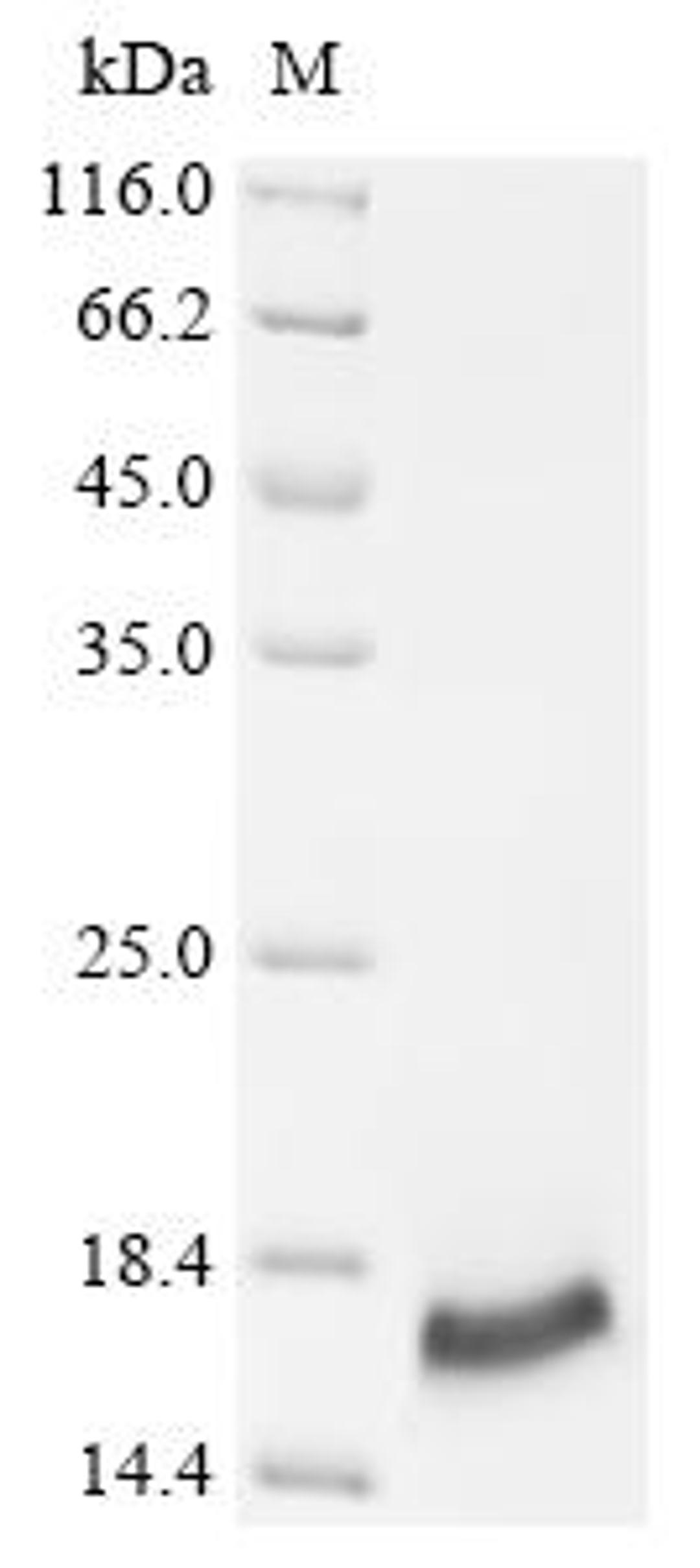 (Tris-Glycine gel) Discontinuous SDS-PAGE (reduced) with 5% enrichment gel and 15% separation gel.