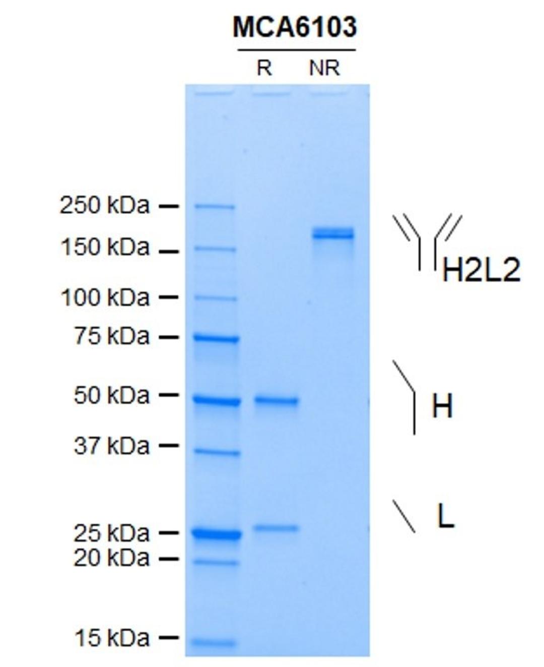 Purity assessment by SDS-PAGE