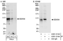 Detection of human DDX54 by western blot and immunoprecipitation.