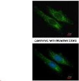 Immunocytochemistry/Immunofluorescence: SUCLG2 Antibody [NBP1-32521] - Methanol-fixed HeLa, using SUCLG2 antibody at 1:200 dilution.