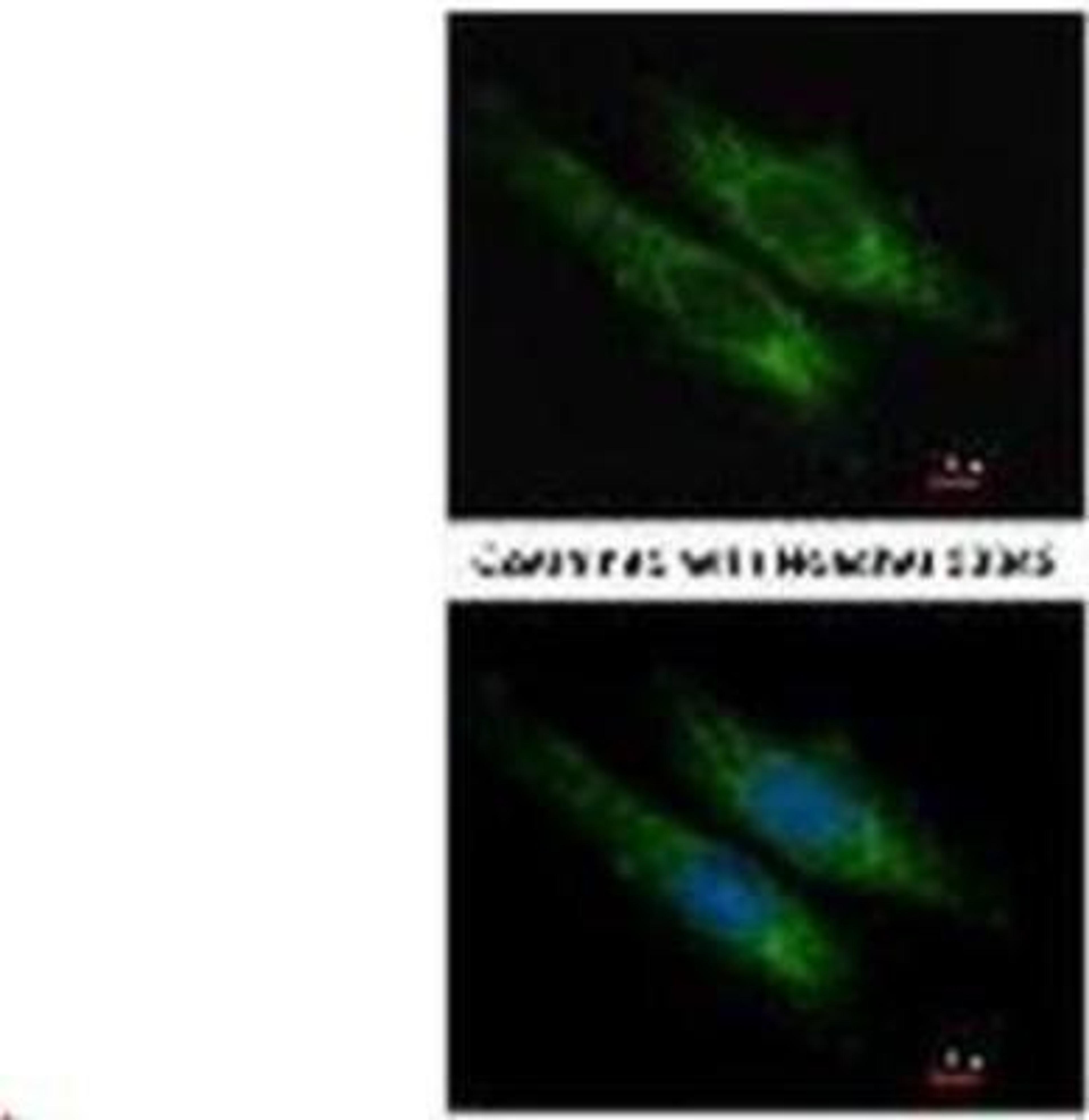 Immunocytochemistry/Immunofluorescence: SUCLG2 Antibody [NBP1-32521] - Methanol-fixed HeLa, using SUCLG2 antibody at 1:200 dilution.