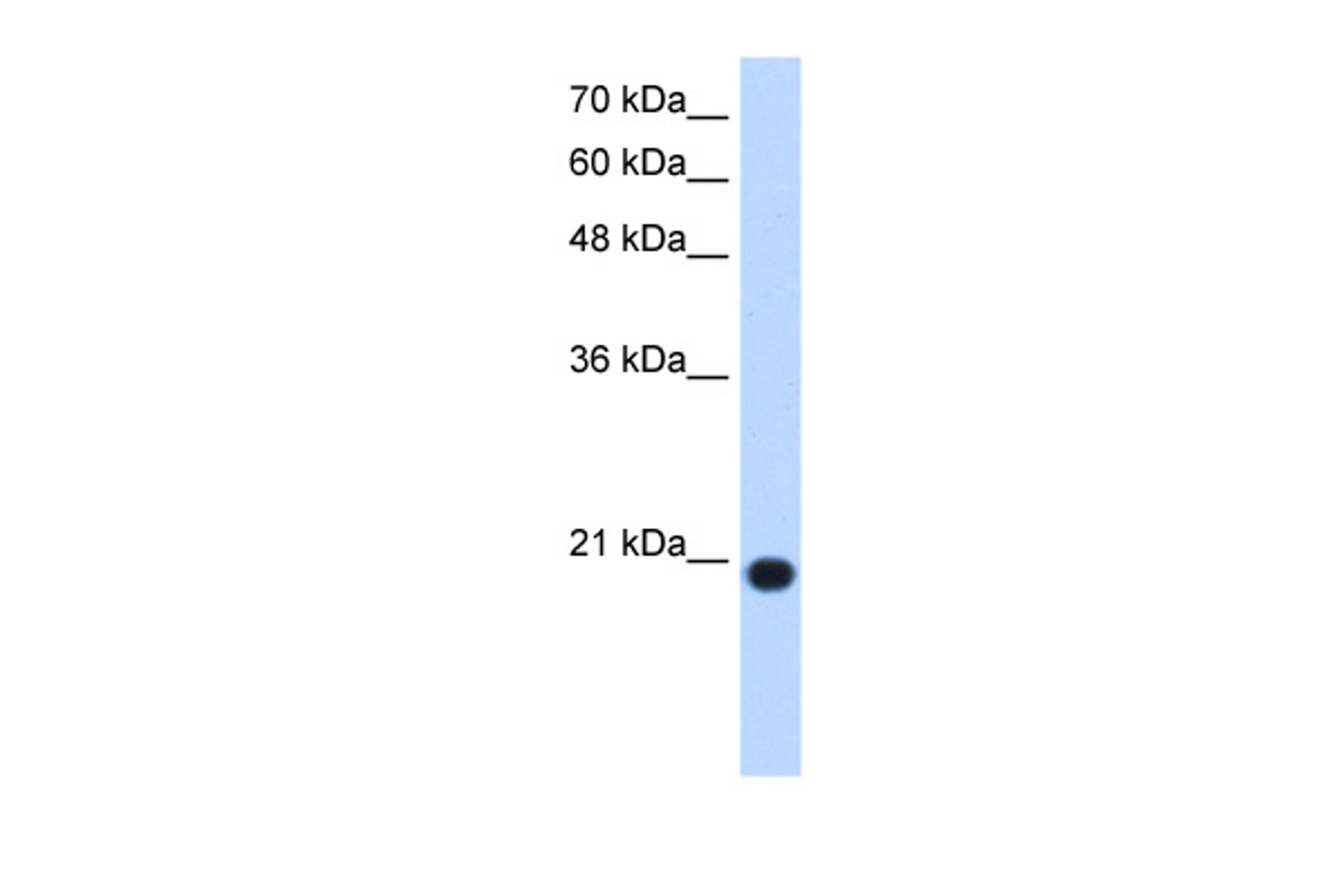 Antibody used in WB on Human HepG2 at 1.25 ug/ml.