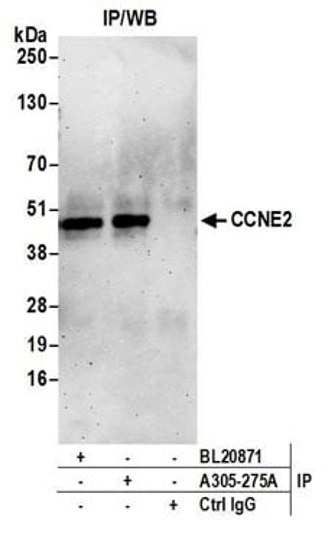 Detection of human CCNE2 by western blot of immunoprecipitates.