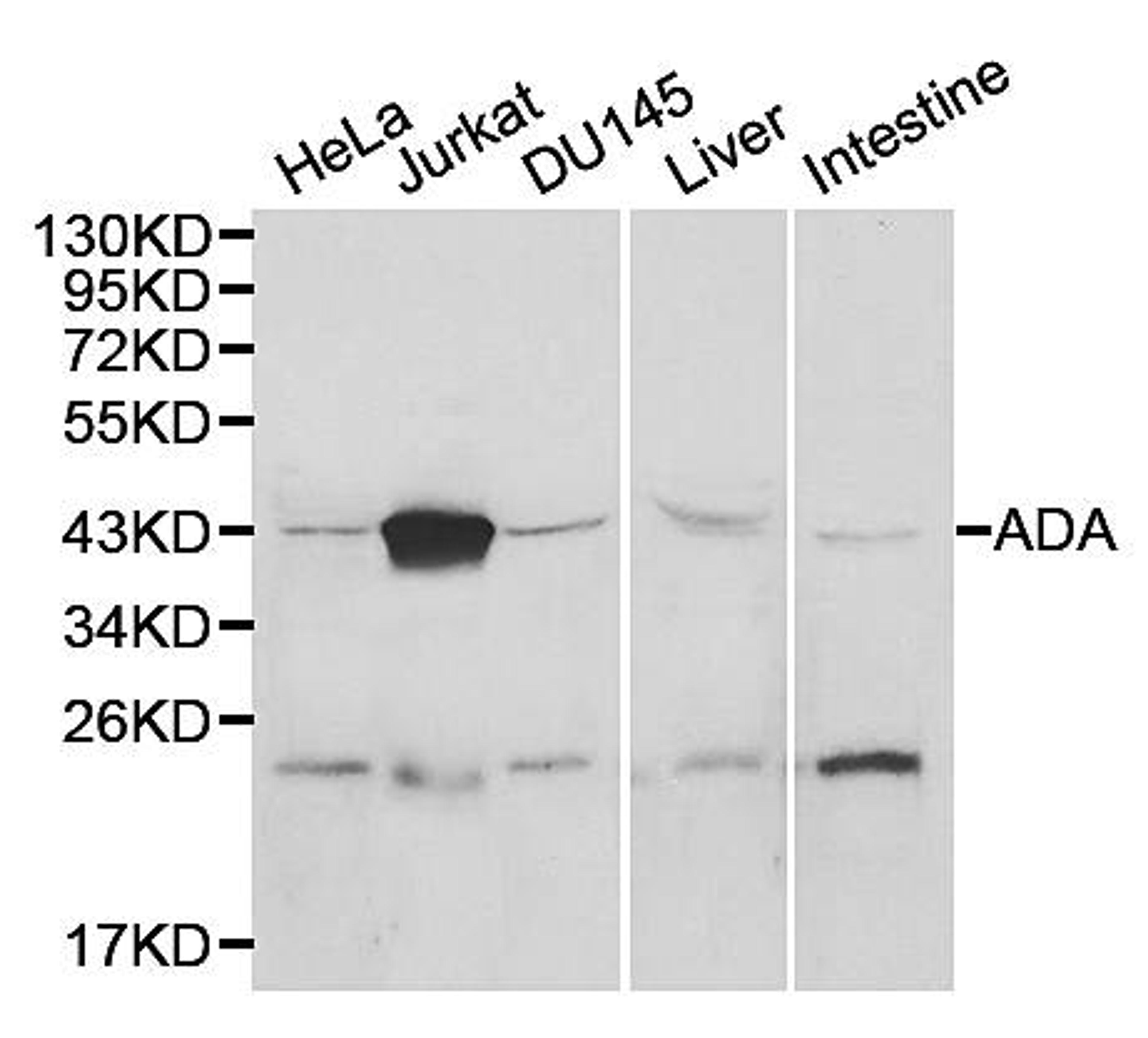 Western blot analysis of HeLa, Jurket, DU145, Liver, Intestine cell line lysates using AK1 antibody