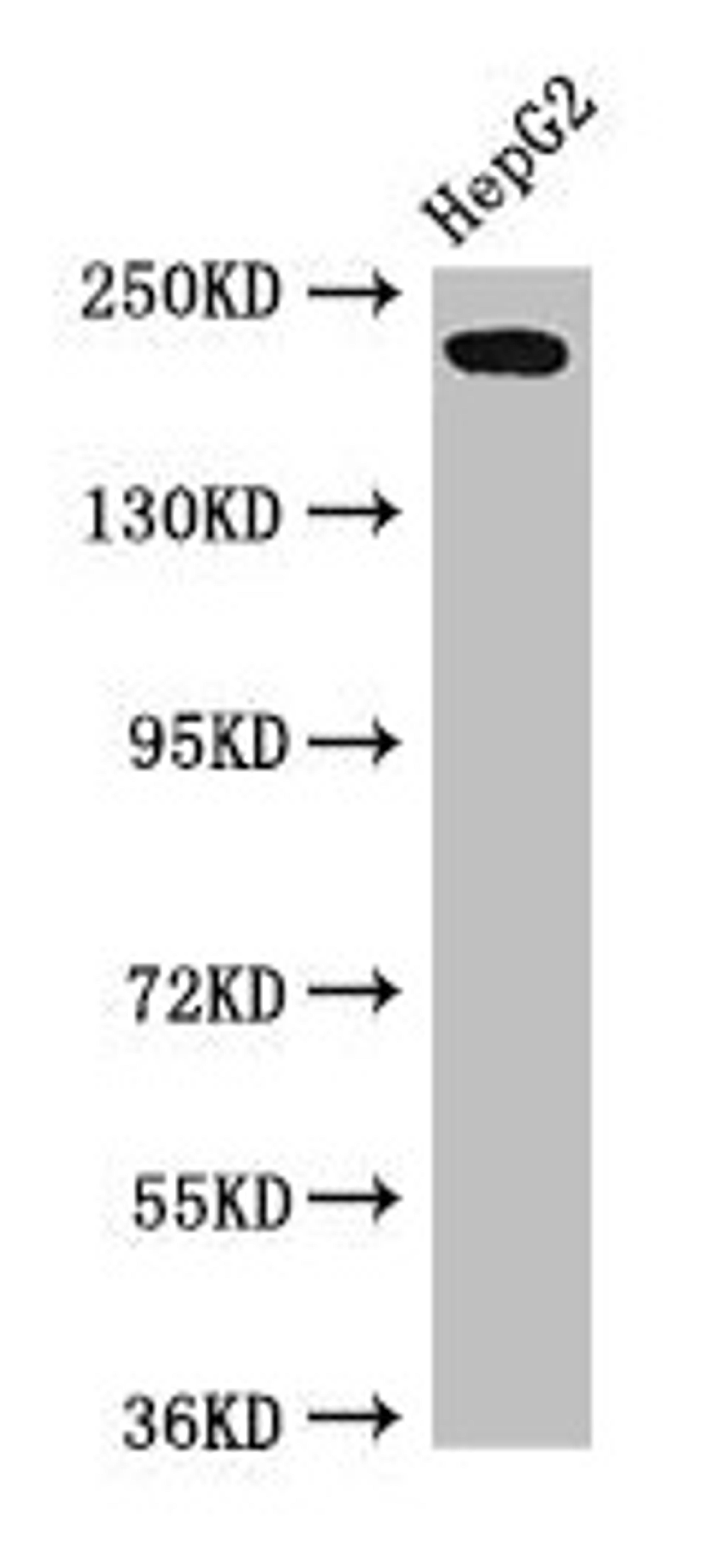 Western Blot. Positive WB detected in: HepG2 whole cell lysate. All lanes: RAI1 antibody at 3µg/ml. Secondary. Goat polyclonal to rabbit IgG at 1/50000 dilution. Predicted band size: 204, 199, 176, 105 kDa. Observed band size: 204 kDa