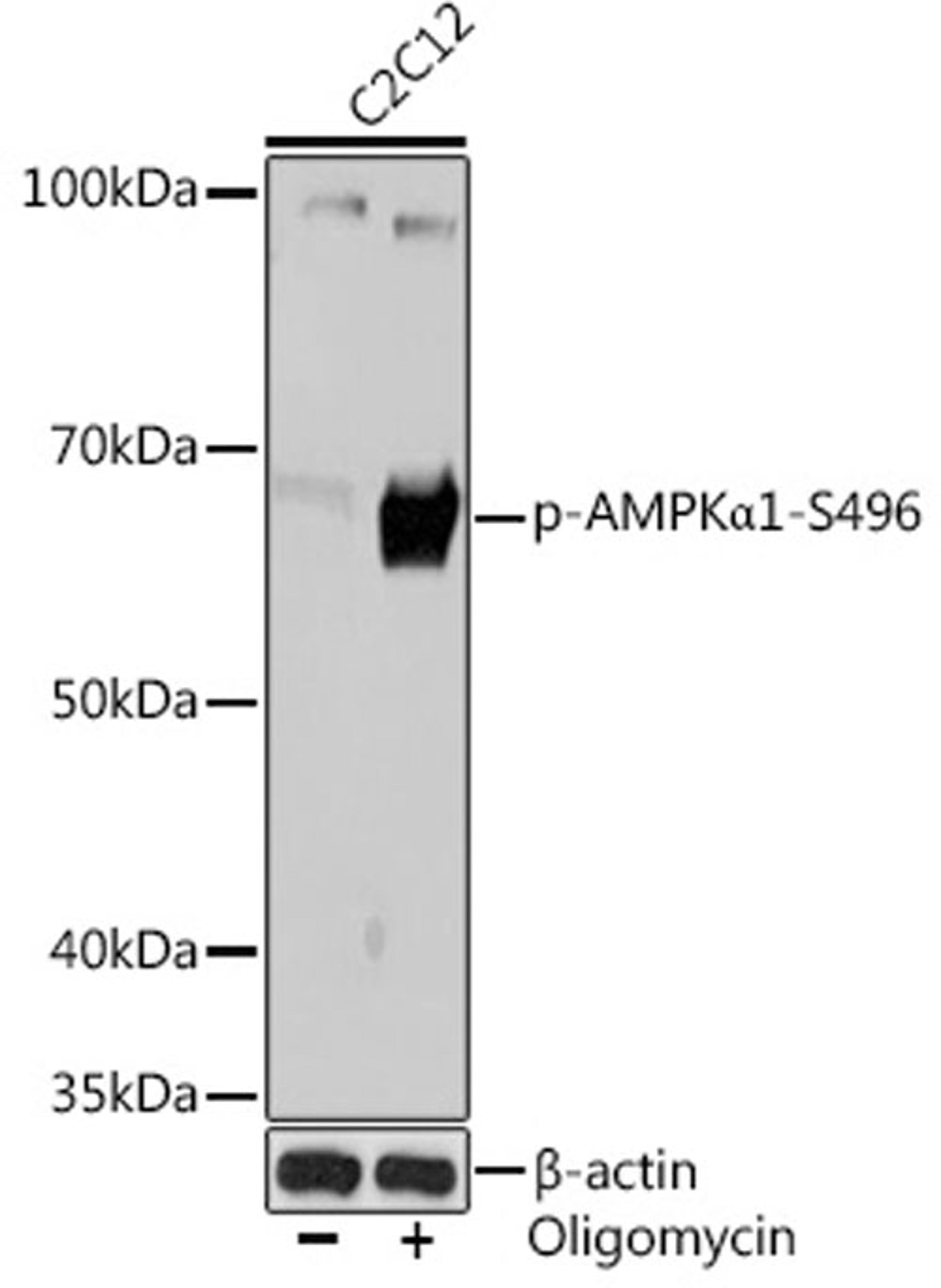 Western blot - Phospho-AMPKa1-S496 Rabbit mAb (AP1002)