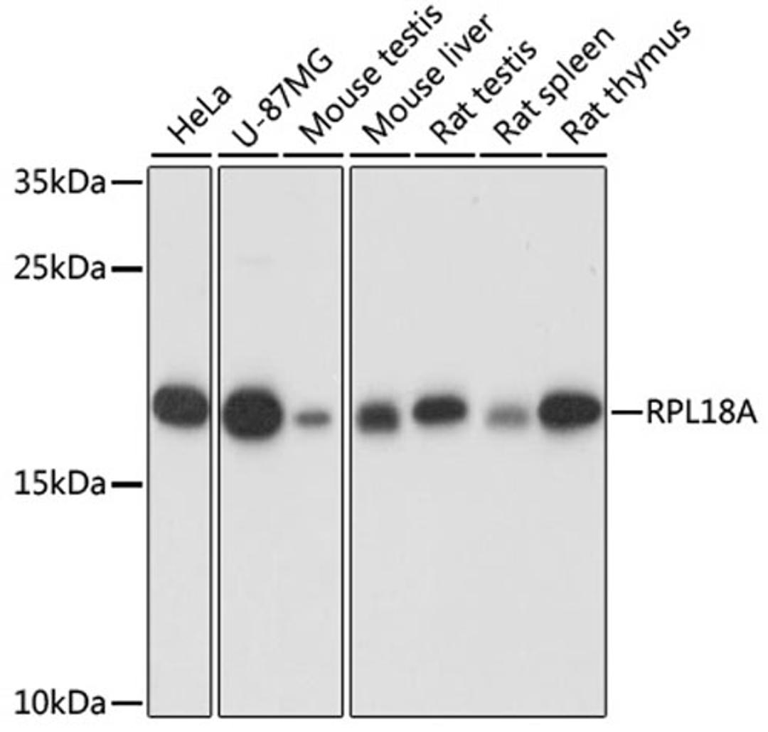 Western blot - RPL18A antibody (A16967)