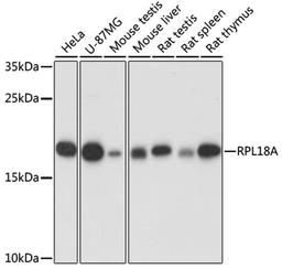 Western blot - RPL18A antibody (A16967)