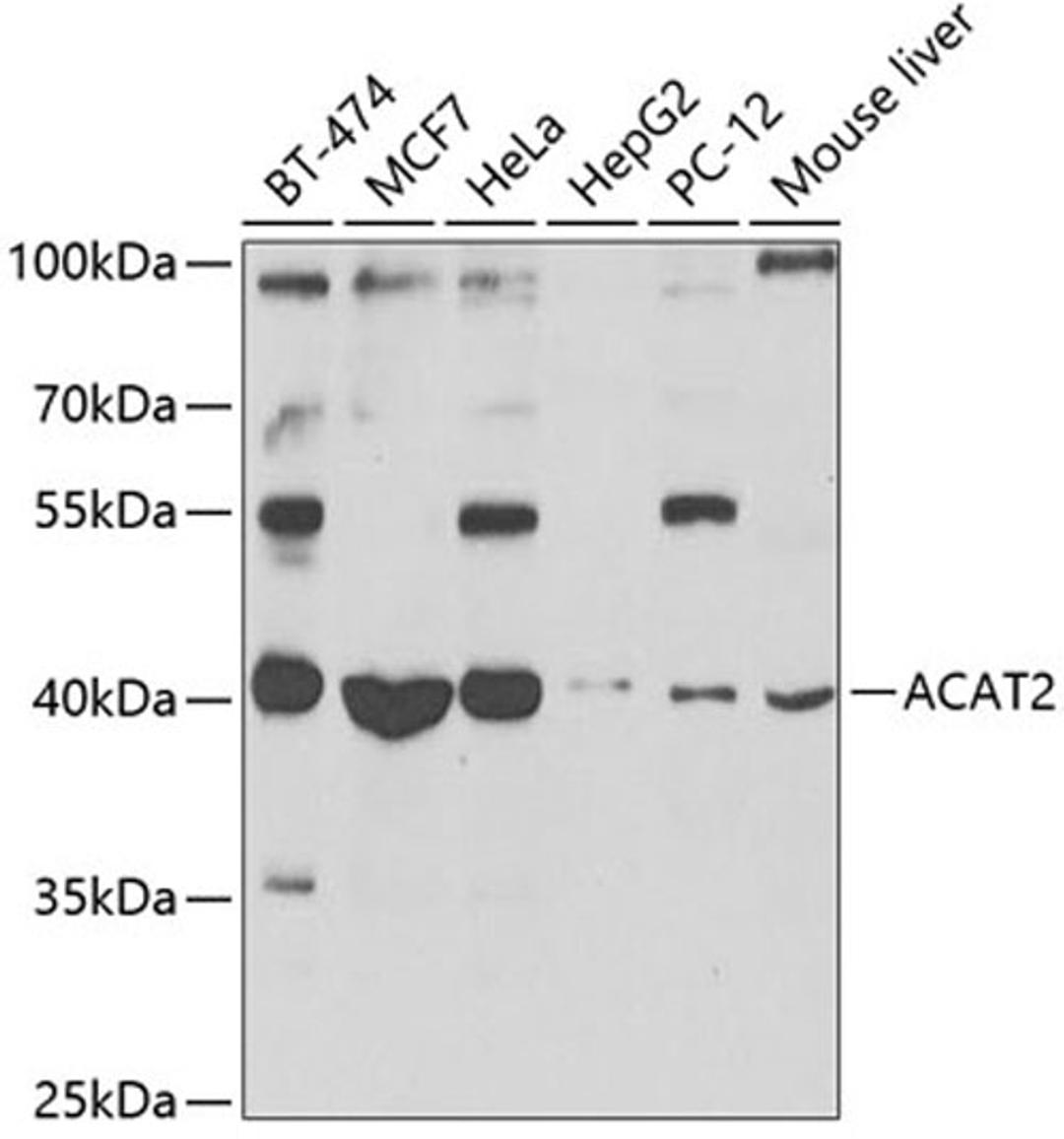 Western blot - ACAT2 antibody (A7866)