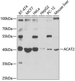 Western blot - ACAT2 antibody (A7866)