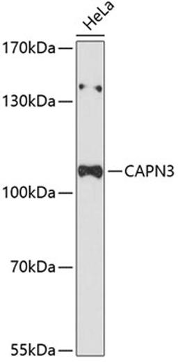 Western blot - CAPN3 Antibody (A12316)