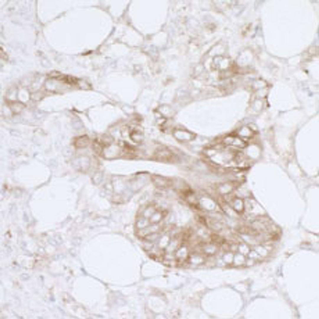 Detection of human MVP by immunohistochemistry.