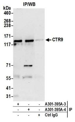 Detection of human CTR9 by western blot of immunoprecipitates.