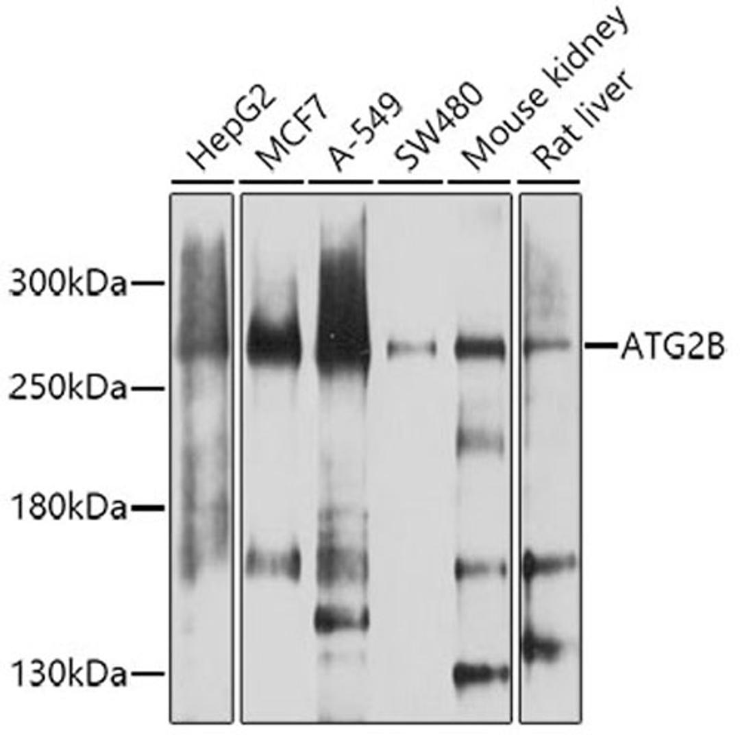 Western blot - ATG2B antibody (A8498)