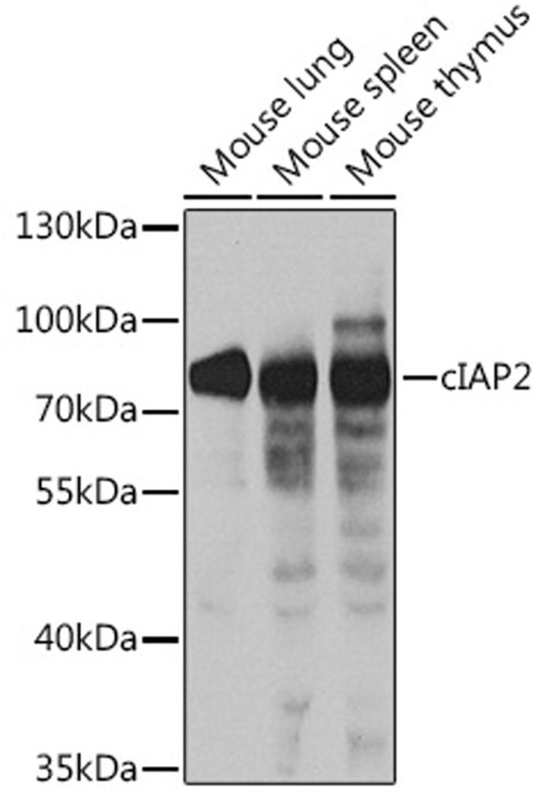 Western blot - cIAP2 antibody (A0833)