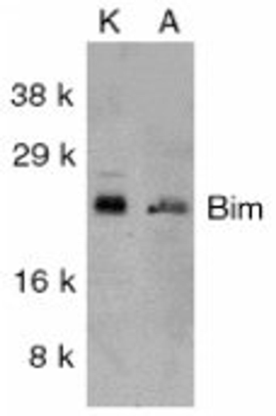 Western blot analysis of whole cell lysates from  K562 (K) and A549 (A) cells