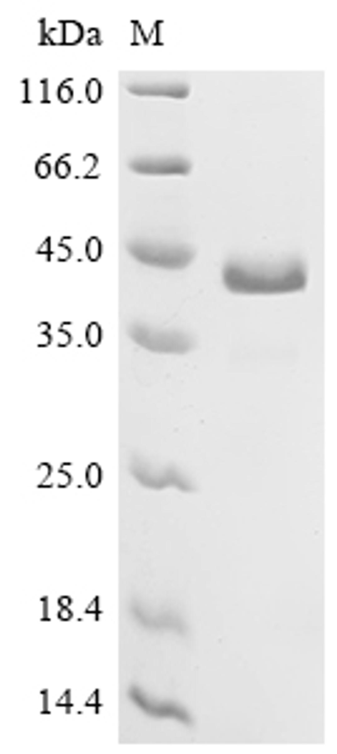 (Tris-Glycine gel) Discontinuous SDS-PAGE (reduced) with 5% enrichment gel and 15% separation gel.