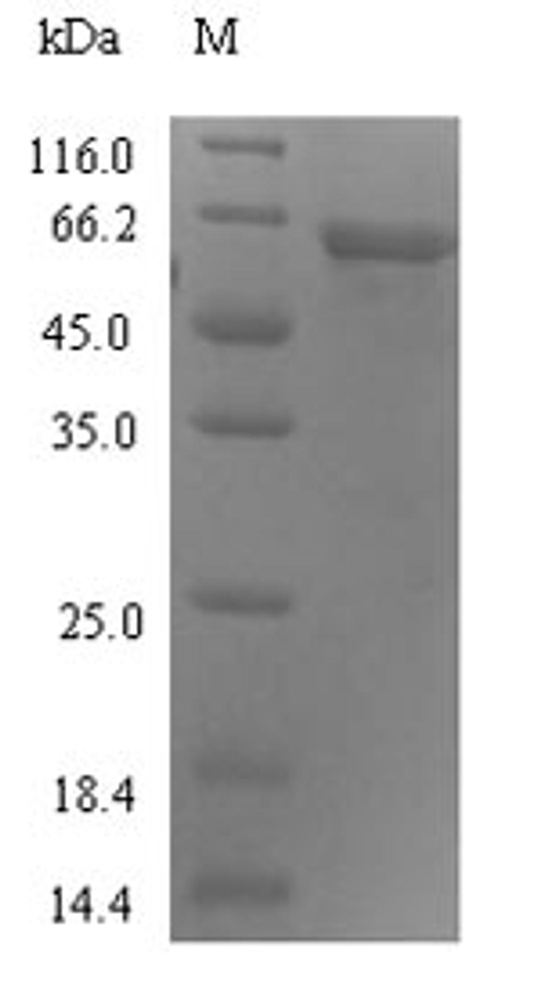 (Tris-Glycine gel) Discontinuous SDS-PAGE (reduced) with 5% enrichment gel and 15% separation gel.