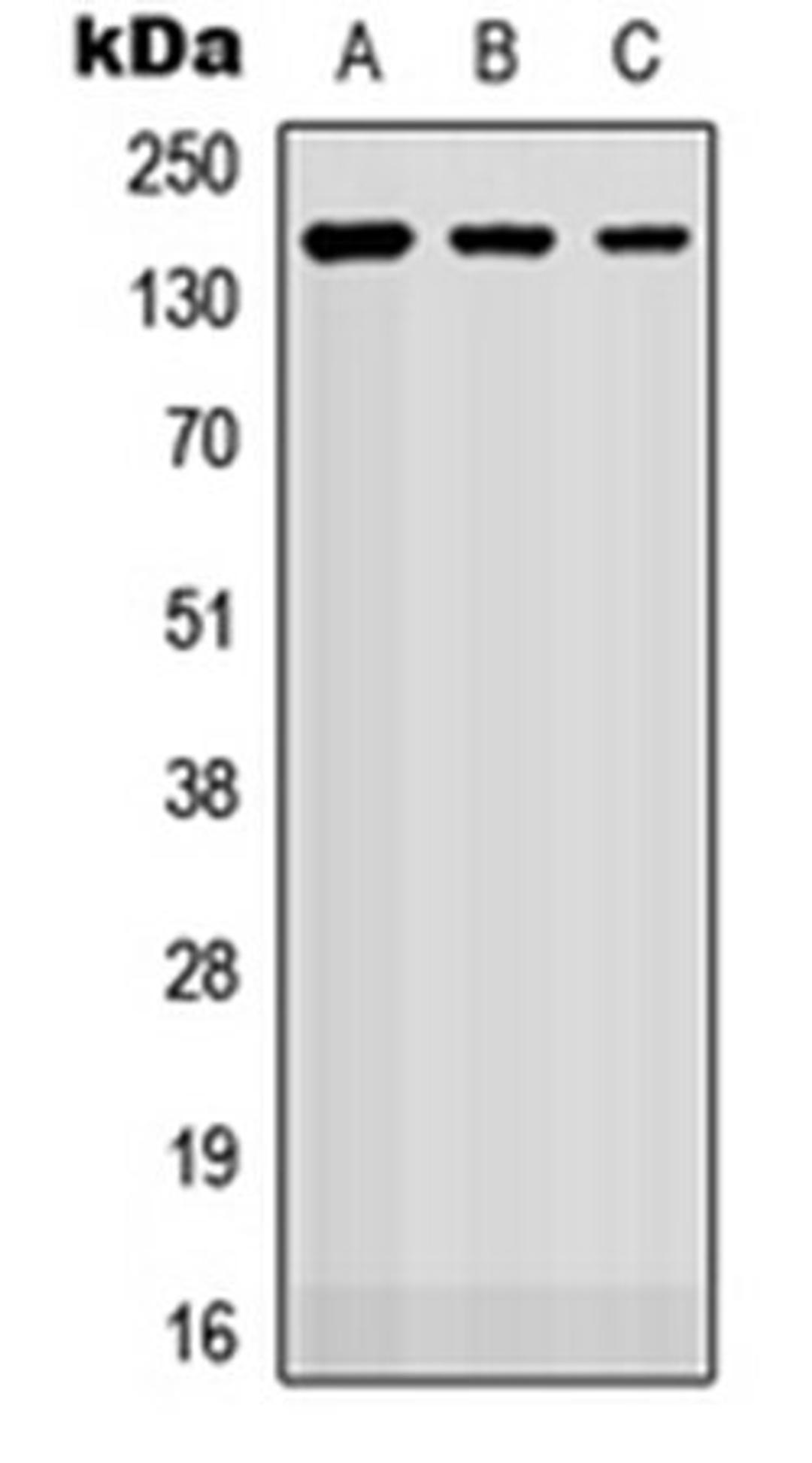 Western blot analysis of HEK293T (Lane 1), Raw264.7 (Lane 2), H9C2 (Lane 3) whole cell lysates using ROBO2 antibody