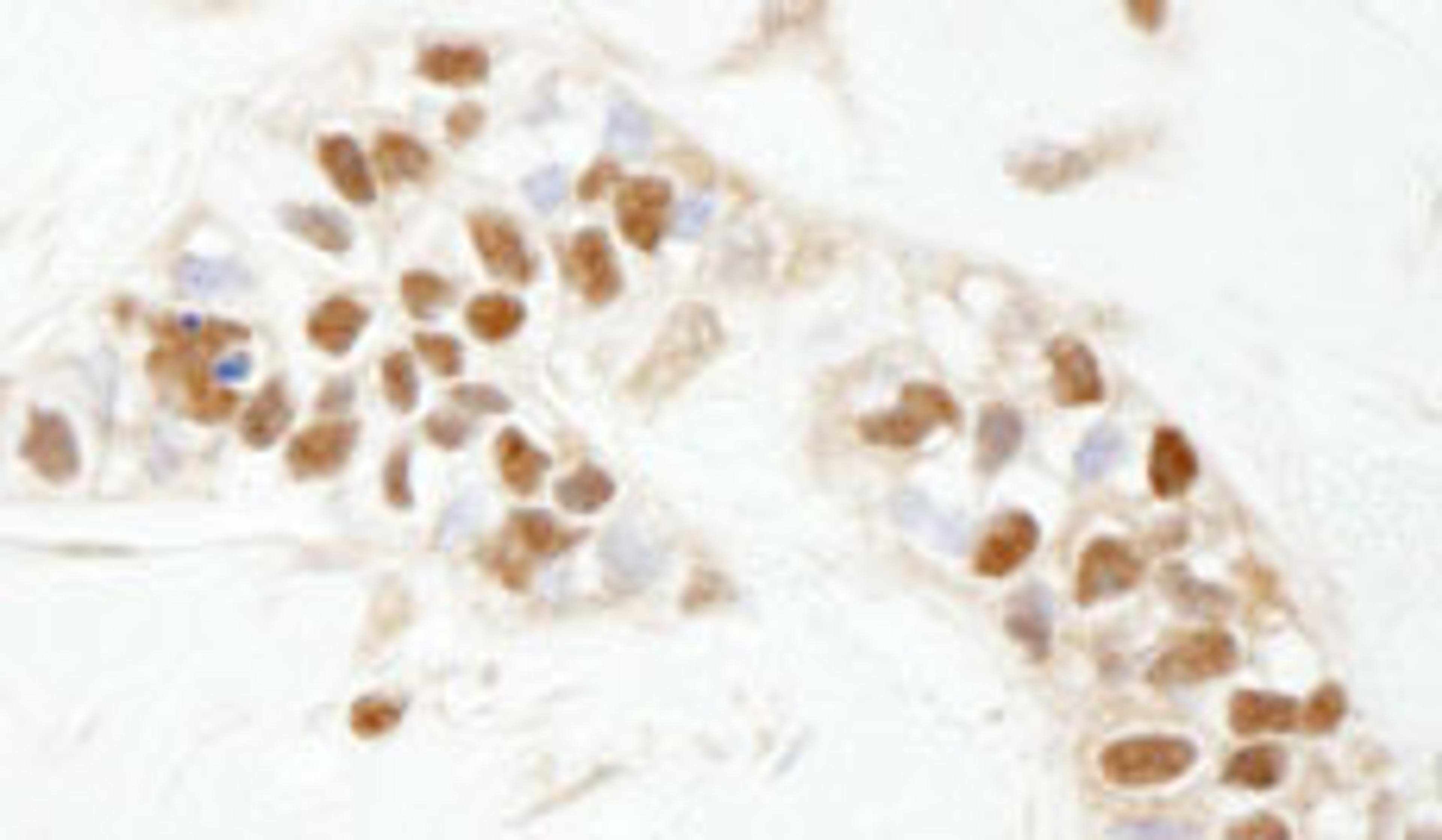 Detection of human PARP1 by immunohistochemistry.