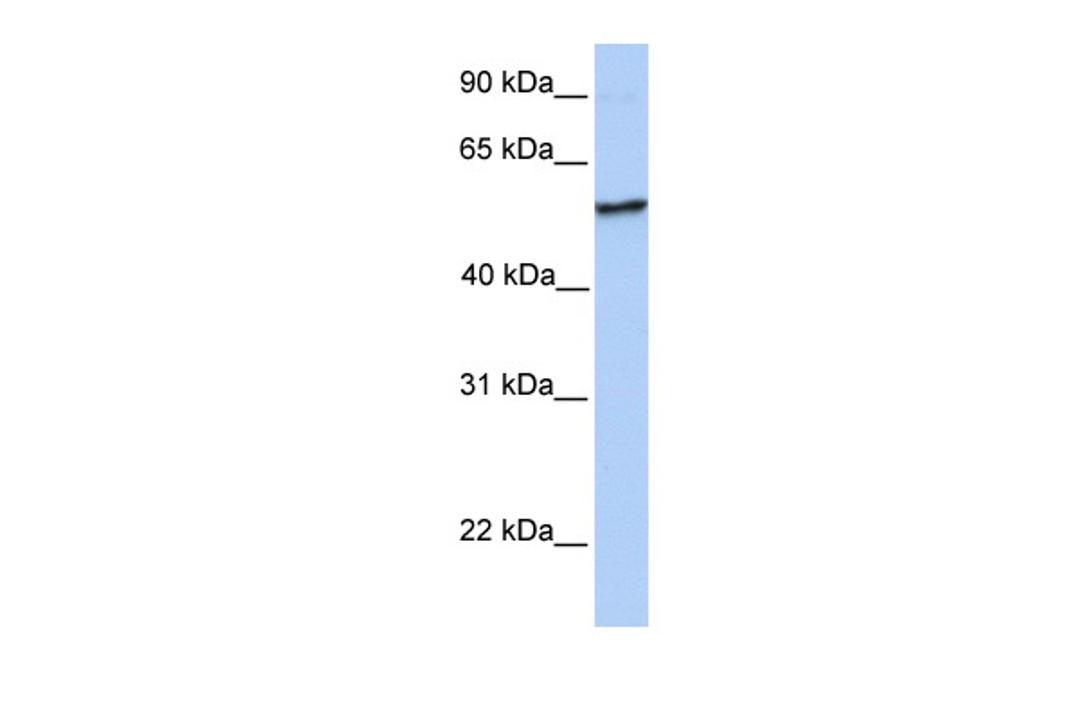 Antibody used in WB on Human Placenta at 0.2-1 ug/ml.