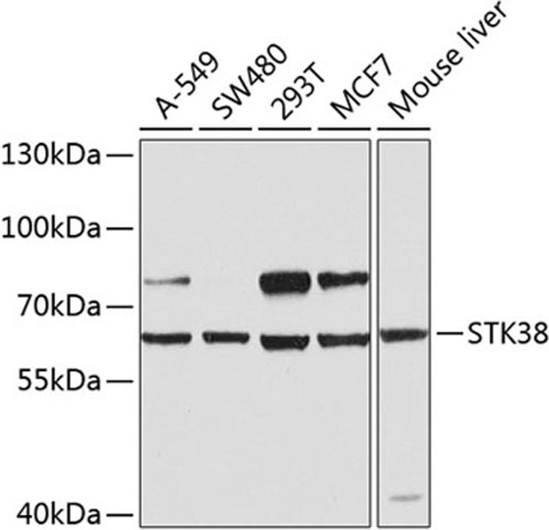 Western blot - STK38 antibody (A8191)