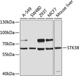 Western blot - STK38 antibody (A8191)