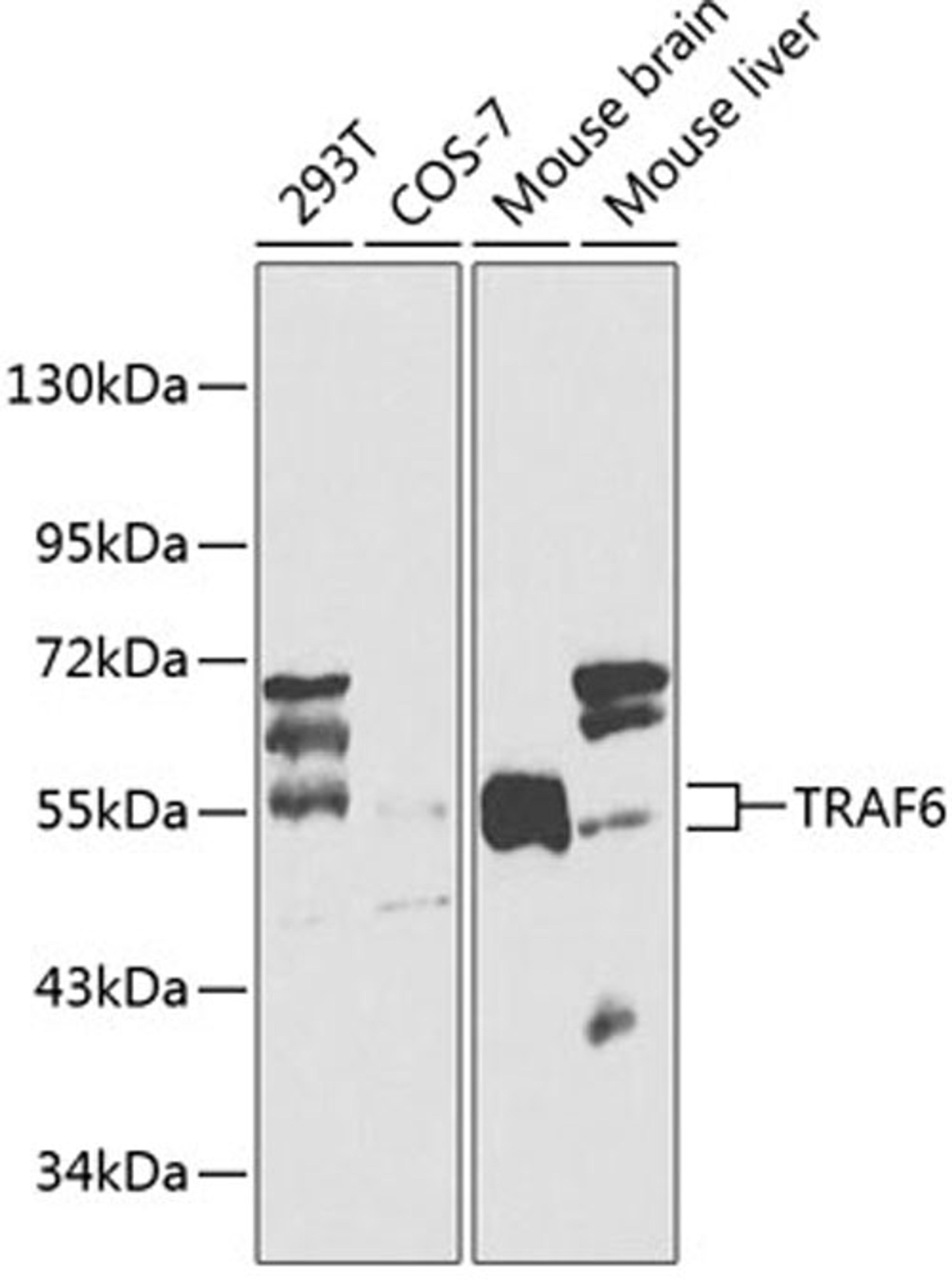 Western blot - TRAF6 antibody (A0973)