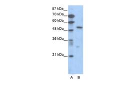 Antibody used in WB on Human Jurkat cells at 0.2-1 ug/ml.