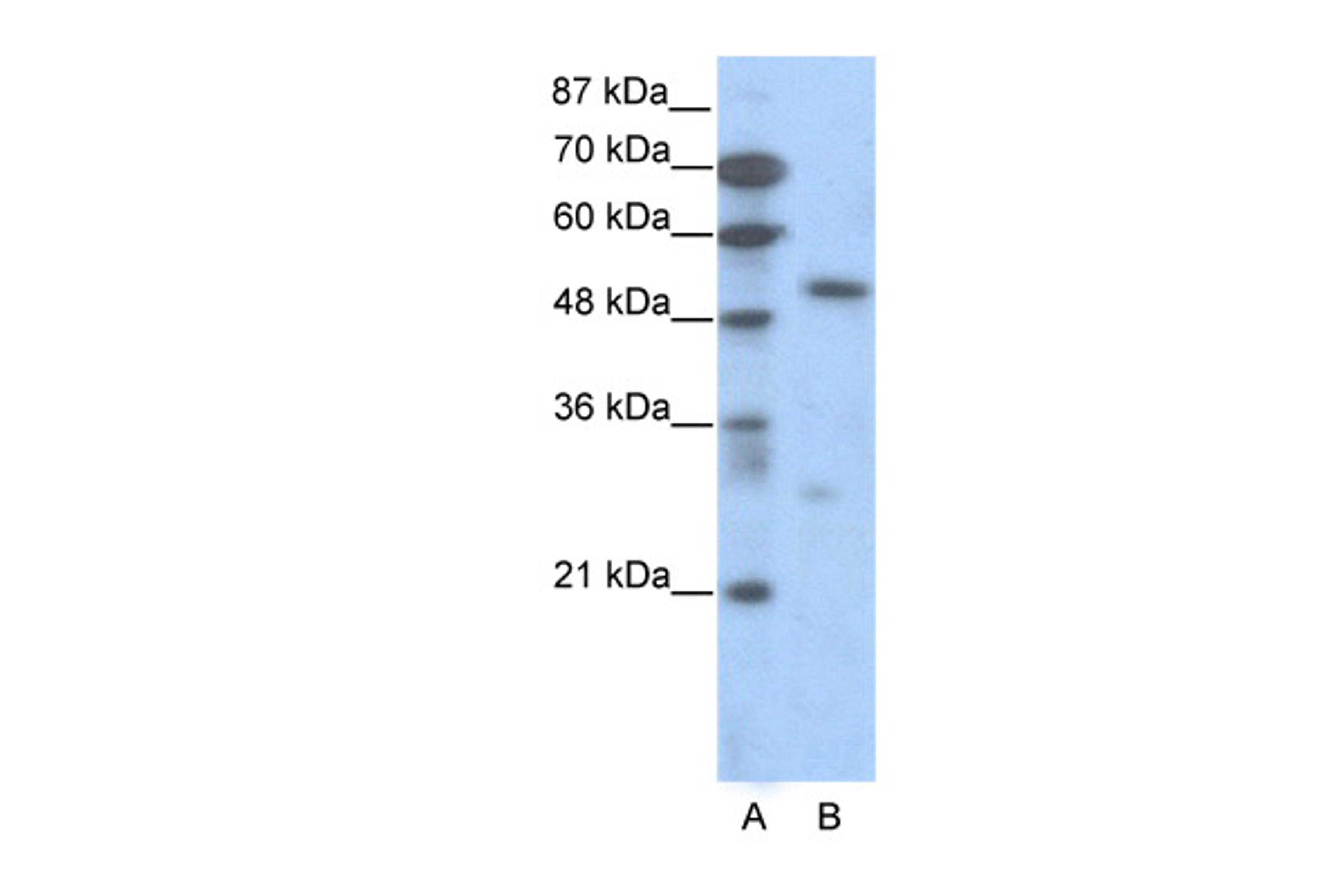 Antibody used in WB on Human Jurkat cells at 0.2-1 ug/ml.