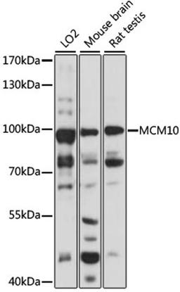 Western blot - MCM10 antibody (A7199)