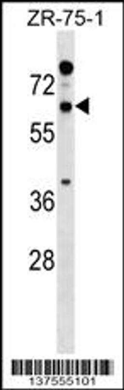 Western blot analysis in ZR-75-1 cell line lysates (35ug/lane).