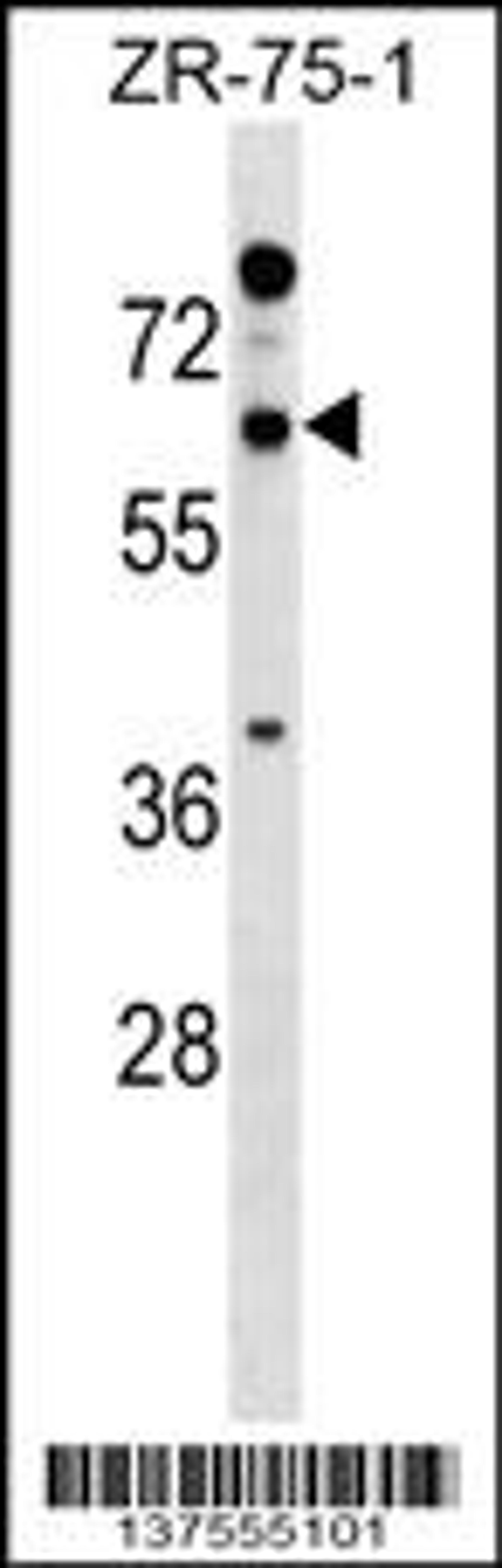 Western blot analysis in ZR-75-1 cell line lysates (35ug/lane).