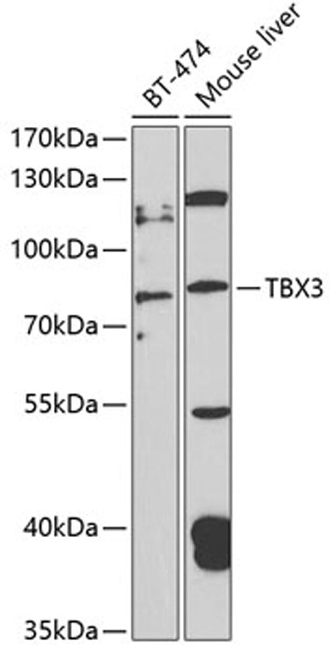 Western blot - TBX3 antibody (A4144)