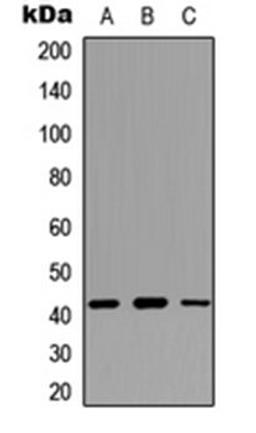 Western blot analysis of MCF7 (Lane 1), NIH3T3 (Lane 2), PC12 (Lane 3) whole cell lysates using Fractalkine antibody