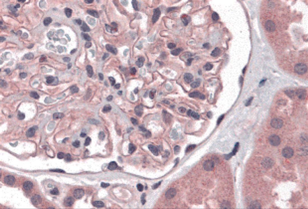 Immunohistochemistry of Nephrin in human kidney tissue with Nephrin antibody at 5 μg/mL.