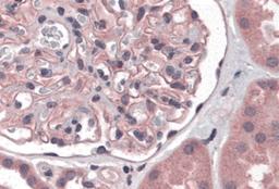 Immunohistochemistry of Nephrin in human kidney tissue with Nephrin antibody at 5 μg/mL.