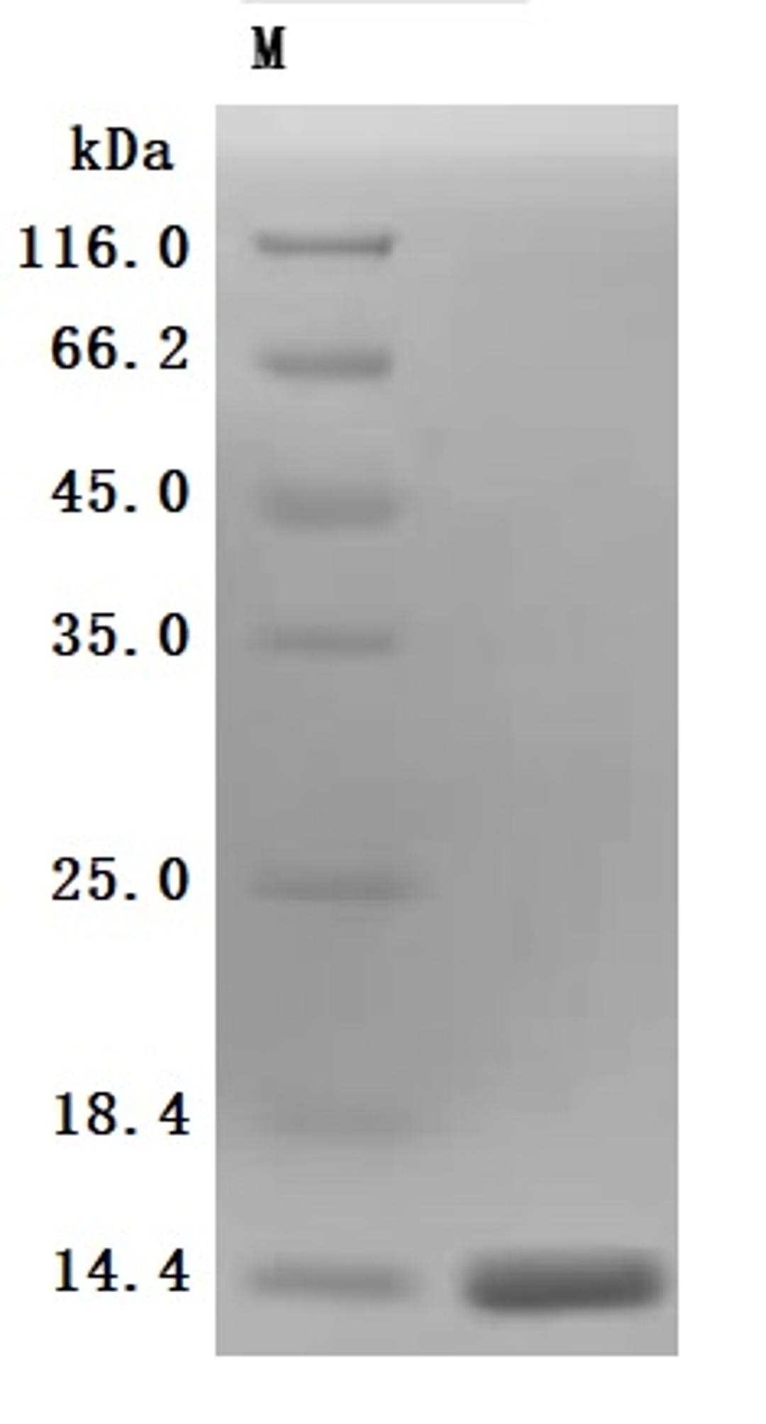 (Tris-Glycine gel) Discontinuous SDS-PAGE (reduced) with 5% enrichment gel and 15% separation gel.