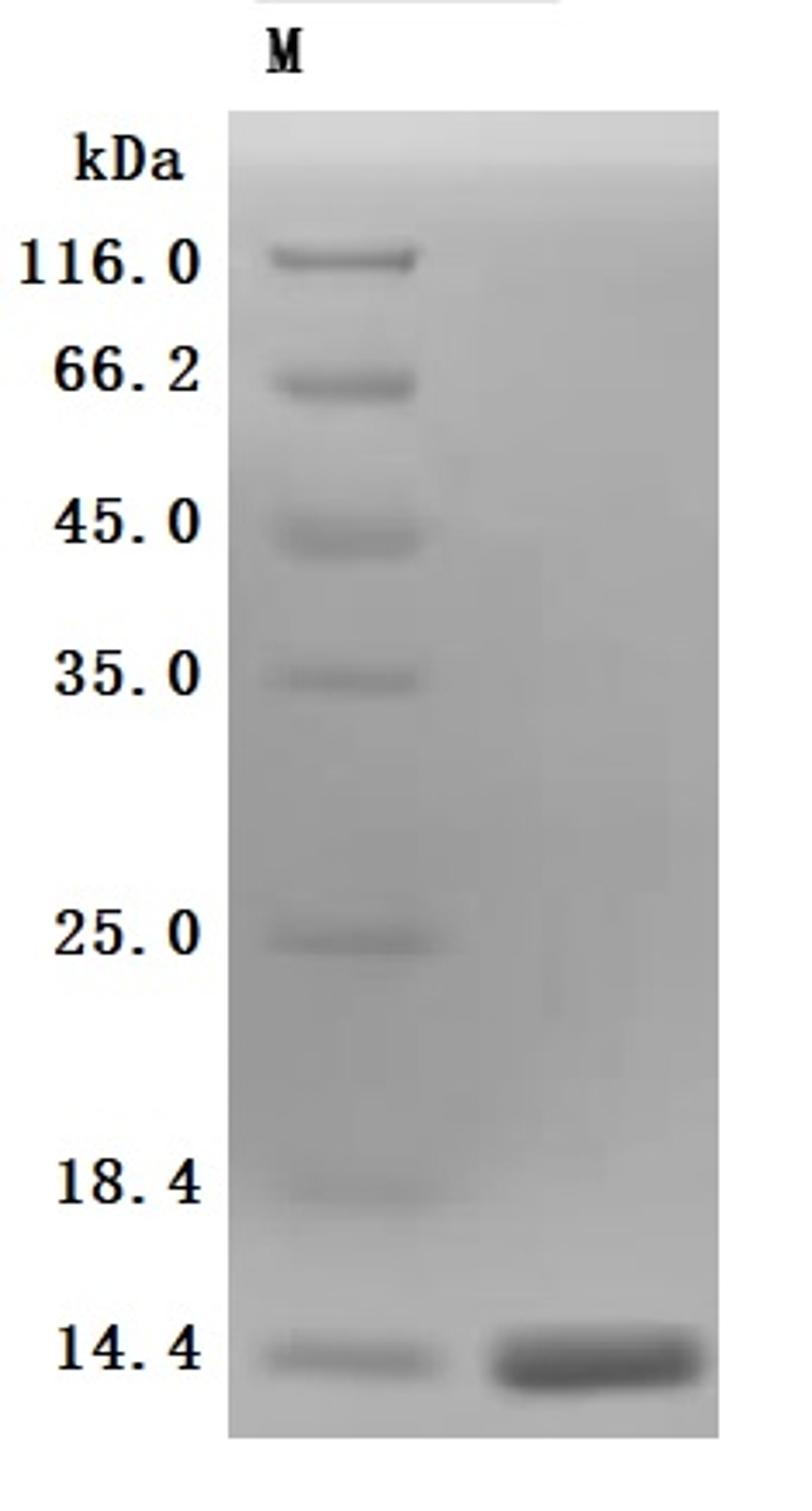 (Tris-Glycine gel) Discontinuous SDS-PAGE (reduced) with 5% enrichment gel and 15% separation gel.
