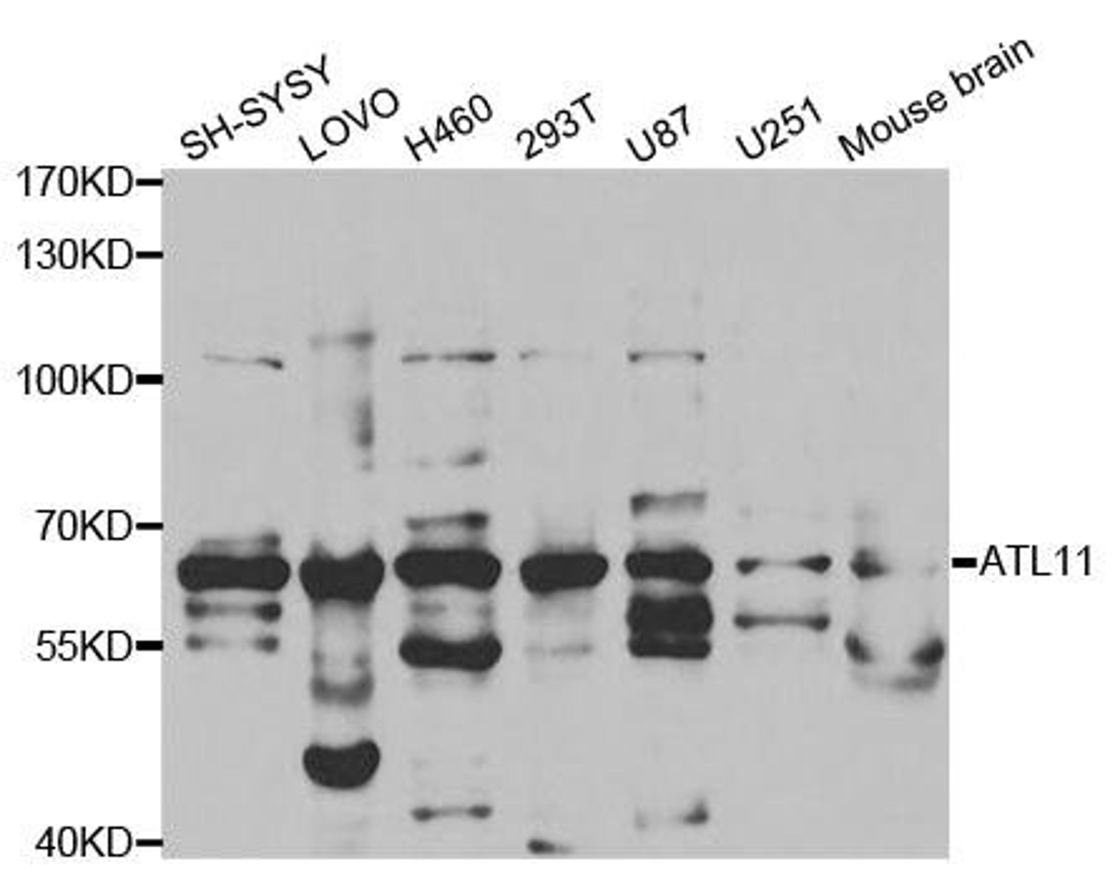 Western blot analysis of extracts of various cell lines using ATL1 antibody