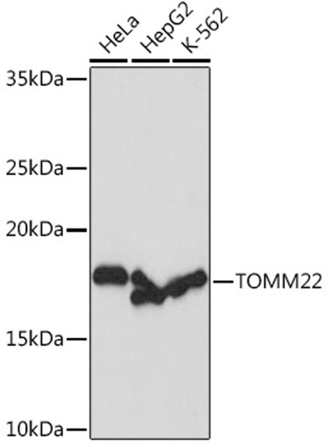 Western blot - TOMM22 Rabbit mAb (A9666)