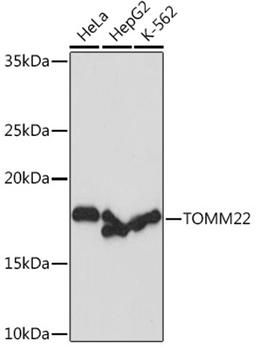 Western blot - TOMM22 Rabbit mAb (A9666)