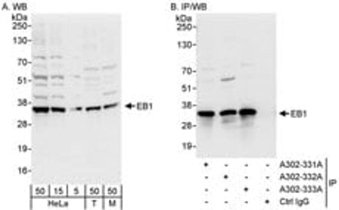 Detection of human and mouse EB1 by western blot (h&m) and immunoprecipitation (h).