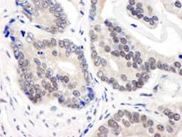 Detection of human CSN3 by immunohistochemistry.