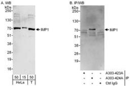 Detection of human IMP1 by western blot and immunoprecipitation.