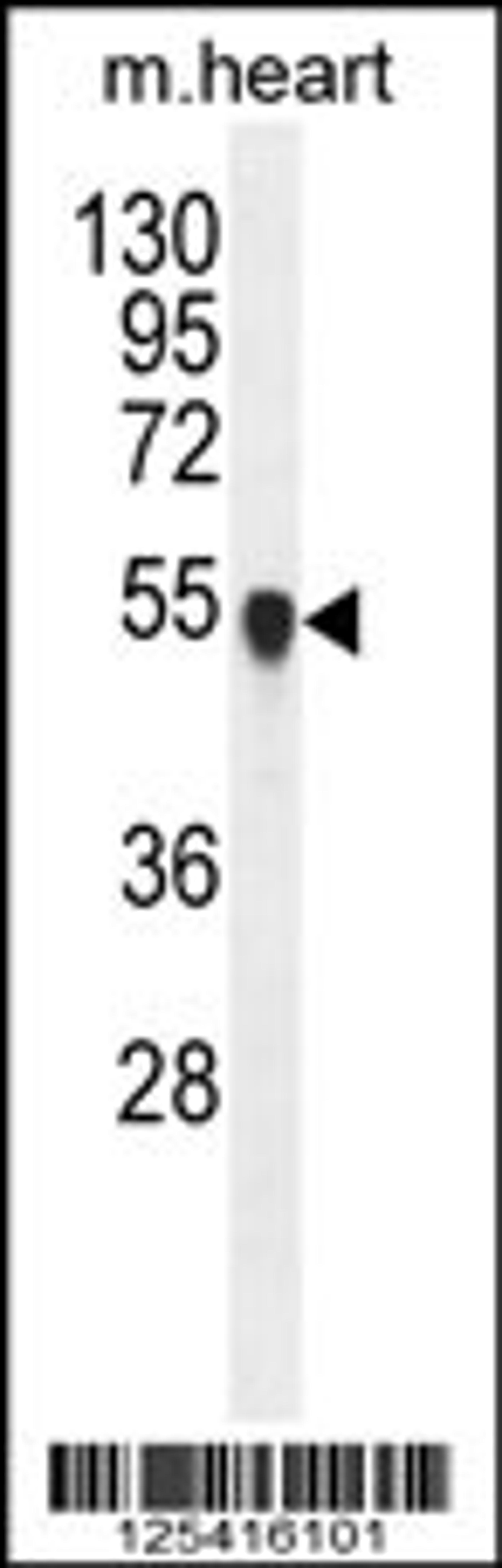 Western blot analysis in mouse heart tissue lysates (35ug/lane).