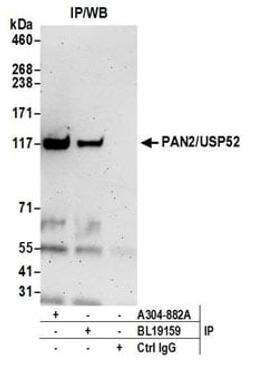 Detection of human PAN2/USP52 by western blot of immunoprecipitates.