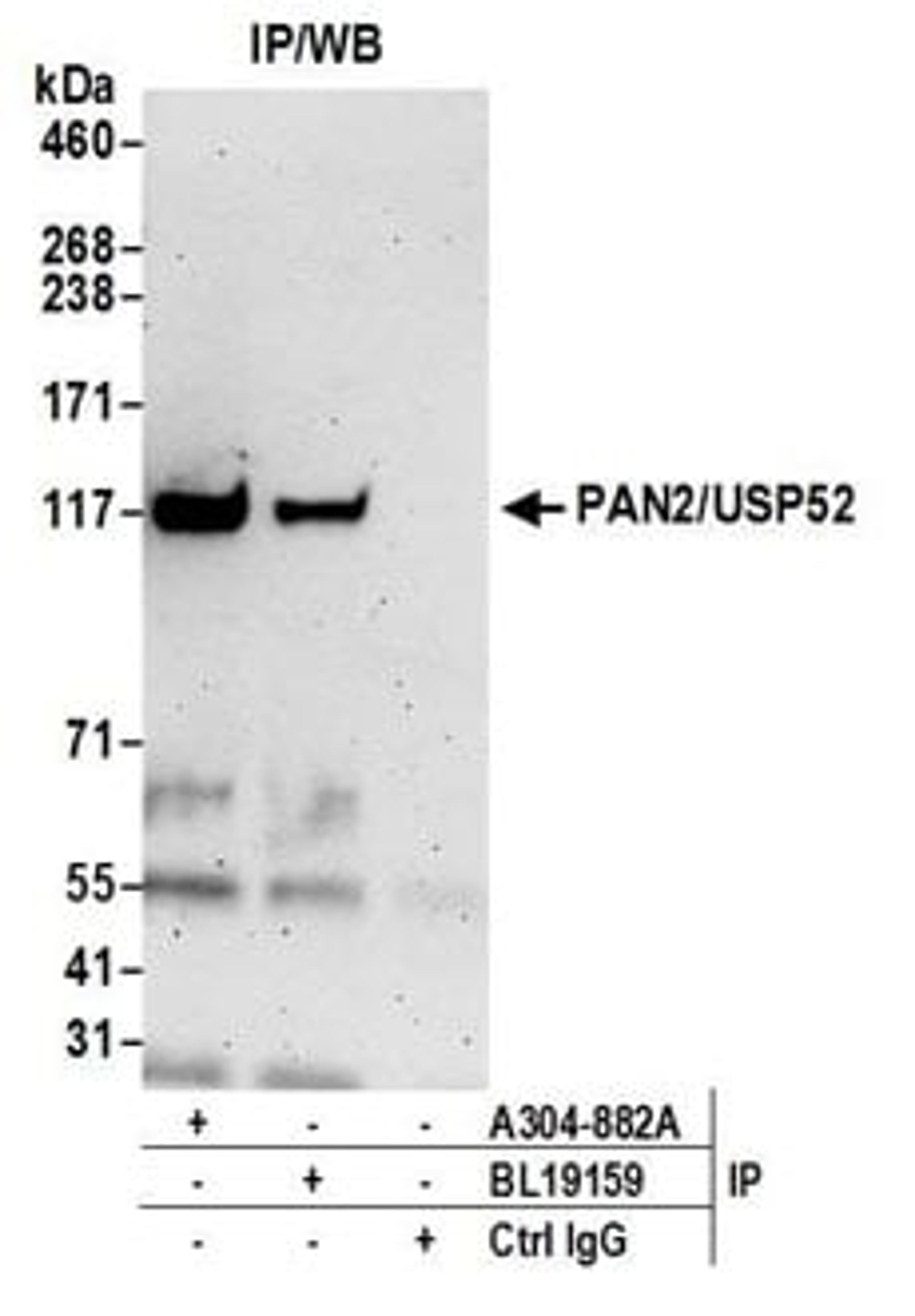 Detection of human PAN2/USP52 by western blot of immunoprecipitates.